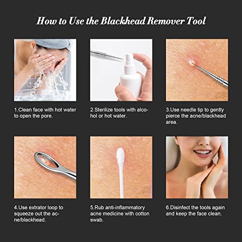 BEZOX Blackhead Remover Tools ALL Stainless Steel – Set of Blackhead Tweezers and Ance Needle with Comedone Extractor, High Temperature Disinfect