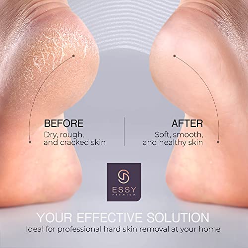 Essy Electric Foot File Pedicure Feet Hard Skin Remover Foot Scraper Dry Dead Skin Remover Callus Exfoliator Rechargeable Feet Scrubber with 5 Re