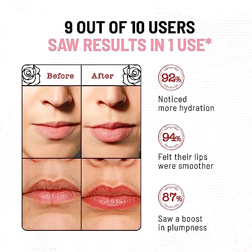 𝗪𝗜𝗡𝗡𝗘? 𝟮𝟬𝟮𝟯* Lip Scrub, Lip Exfoliator and Moisturizer for Lightening and Brightening Lips, Made with Pure Beeswax with Vitamin C and E for Hydra