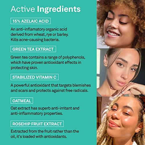 facetheory Lumizela S9-15% Azelaic Acid, Acne Serum Reduces Inflammation, Smooth Emulsion, Green Tea Serum, Calming Aloe Vera, Vegan, and Cruelty