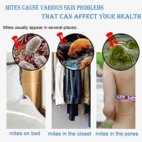 Allbestaye Mite Remove Soap Facial Soap Rich In Sea Salt Quickly Mites Repair Nourish Cleansing (1PC)