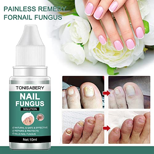 Fungal Nail Treatment for Toenail Extra Strong, Ingrown Toenail Treatment Nail Care Oils, Anti Toe Nail Fungus Treatment for Toenail Nail Fungal
