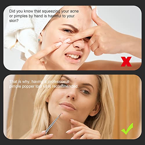 BEZOX Blackhead Remover Tools ALL Stainless Steel – Set of Blackhead Tweezers and Ance Needle with Comedone Extractor, High Temperature Disinfect