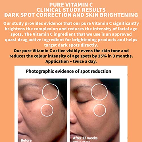 Nature Spell Pure Vitamin C Face Serum 30 ml - Brightens Skin - Minimise Enlarged Pores – Anti Aging Serum for Face - Suitable for All Skin Types