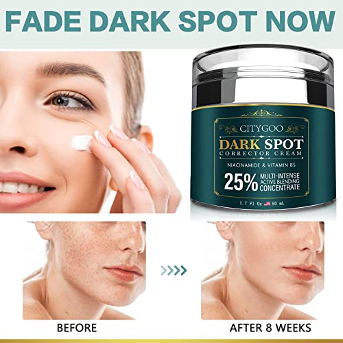 Dark Spot Remover for Face and body, Dark Spot Corrector Cream-for Dark Spots, Sun Spots, Age Spots, Hyperpigmentation and Even Skin Tone-1.7 Oz