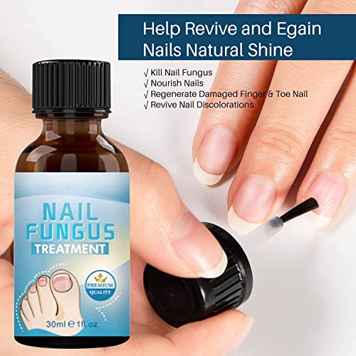 Fungal Nail treatment,Premium Fungal Nail Eliminator for Toenails and Fingernails, Nail Fungus Treatment,Anti fungal Nail Repair and Strengthen —