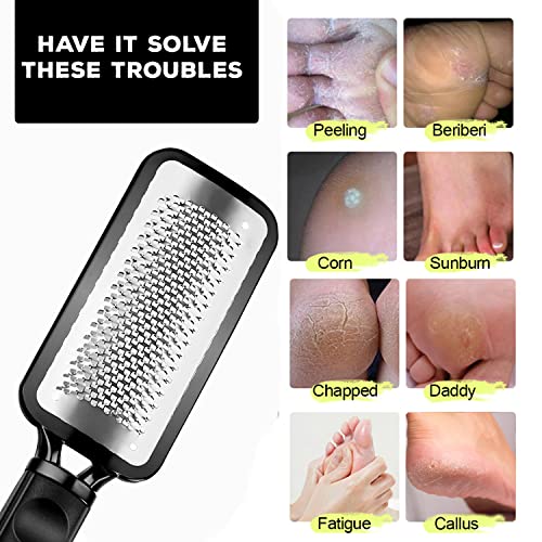 Foot Files for Hard Skin Pedicure Metal Surface Foot Scraper Dead Skin Remover for Feet Callus Rasp