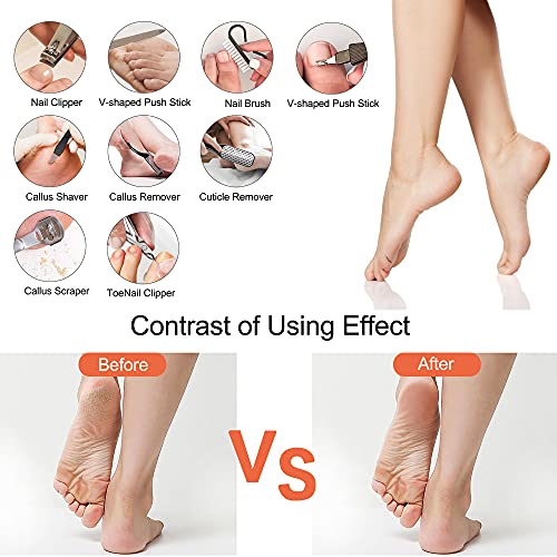 Ratukall Electric Foot File Callus Remover, Waterproof 16 in 1 Professional Pedicure Tools Set, Feet Scrubber Dead Skin Hard Skin Cracked Heels C