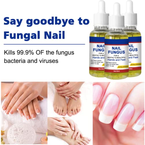 Nail Fungal Treatment, Toenail Treatment Extra Strong Nail Repair Set, Fingernail Toenail Care, Fix Renew Damaged, Broken, Anti Fungus Nail Repai
