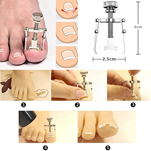 MojiDecor Ingrown Toenail Filae and Ingrowing Toenail File, Professional Nail Care Set 6PCS Premium Stainless Steel Manicure Pedicure Set, Nail N