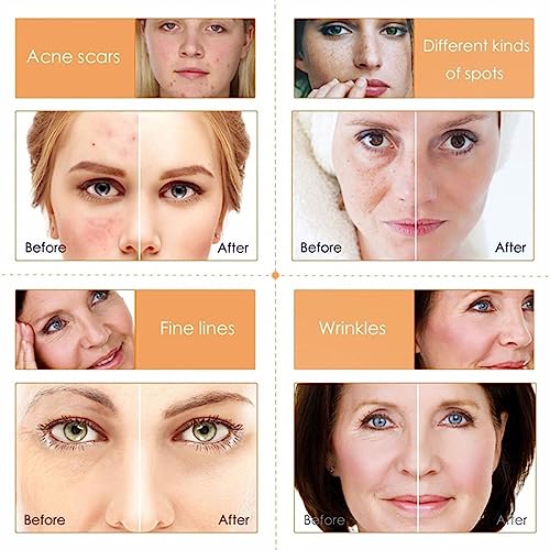 Skincare Gifts For Teenage Girls,Facial kit,Vitamin C Skincare sets, Pamper Sets For Women Gifts With Skin Care Sets & Kits Includes Cleanser, Fa