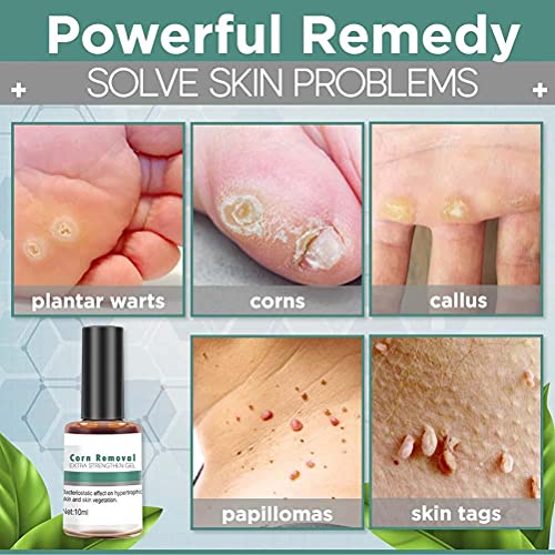 BTSEURY Wart Remover Extra Strengthen Gel, Corn Removal Extra Strengthen Gel, Quick Corn Remover Liquid, Mild Corn Callus Remover for Feet