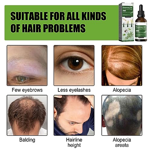 Rosemary Essential Oil For Hair Growth, Natural Rosemary Oil For Hair & Eyelashes Growth, Hair Strengthening Oil Improve Hair Loss, For Growth An