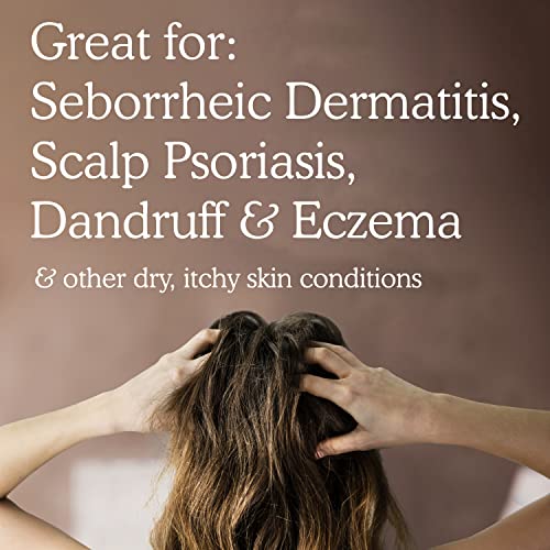 Balmonds Scalp & Beard Oil 50 millilitres - Natural Treatment for Scalp Eczema Psoriasis and Seborrheic Dermatitis - Relief From Dry, Itchy Scalp