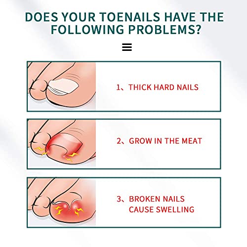 Ingrown Toenail Tool Kit, Toe Nail Nippers Set for Ingrown & Thick Nail, Surgery Grade Manicure Pedicure Tool, Nail File Lifter Pusher Corrector