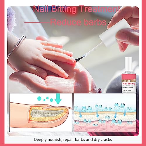 Anti Nail Biting Nail Polish, Stop Nail Repair Nail Varnish, Stop Biting Your Nails, Nail Biting Prevention, Clear Nail Varnish, Nail Biting Trea