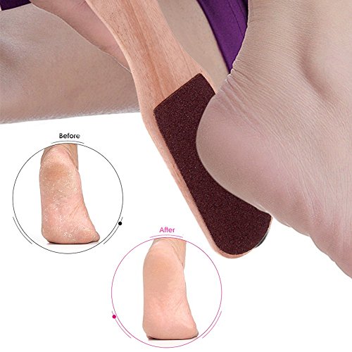 Anself Double Sided Foot Rasp Manicure File Callus Remover Pedicure Tool
