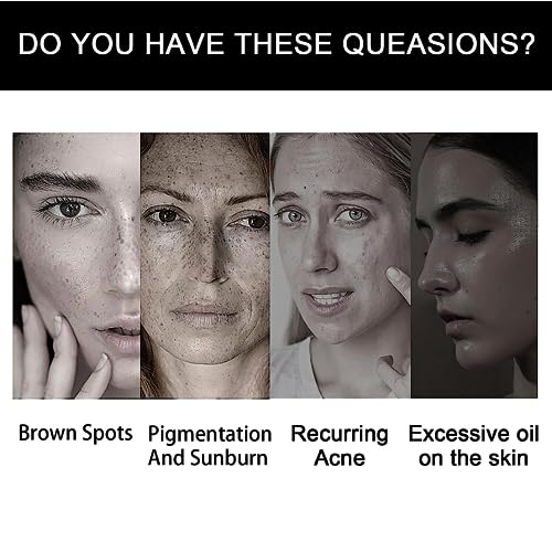 Face Moisturiser, Retinoid 2% Emulsion Retinol Serum High Strength for Face, Retinol Face Serum, Fine Line Anti Wrinkle Serum, Acne Reduced, Brig