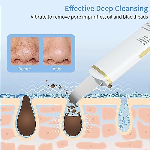 GUGUG Facial Skin Scrubber, Ultrasonic Skin Spatula Face Blackhead Remover Scraper with Four Modes for Deep Cleansing, Portable and Rechargeable
