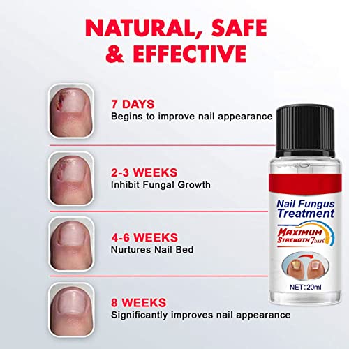 Fungal Nail Treatment 20ml, Extra Strong Nail Fungus Treatment for Toenail and Fingernail, Premium Fungal Nail Eliminator, Anti fungus Nail Repai