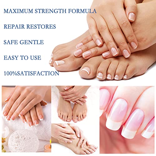 Fungal Nail treatment,Premium Fungal Nail Eliminator for Toenails and Fingernails, Nail Fungus Treatment,Anti fungal Nail Repair and Strengthen —