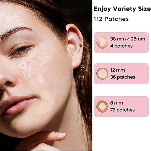 Spot Patches, Acne Patch 112 Pcs, Hydrocolloid Pimple Patches, Korintin Acne Patches for Large Zit Breakouts, 3 Sizes (8mm, 10mm, 38mm x 26mm)
