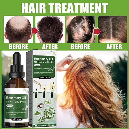 Rosemary Essential Oil For Hair Growth, Natural Rosemary Oil For Hair & Eyelashes Growth, Hair Strengthening Oil Improve Hair Loss, For Growth An