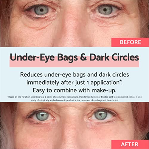 Remescar Eye Bags & Dark Circles 8ml - Eye Cream for Under Eye Bags and Remove Bags Under Eyes - Instant Eye Bag Treatment - 180 Applications