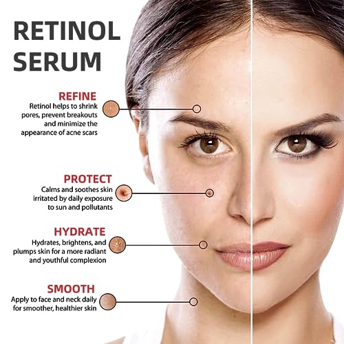 Face Moisturiser, Retinoid 2% Emulsion Retinol Serum High Strength for Face, Retinol Face Serum, Fine Line Anti Wrinkle Serum, Acne Reduced, Brig