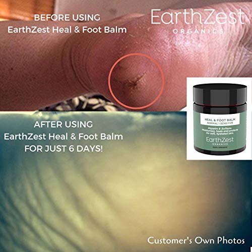 Foot Cream Day & Overnight Treatment by EarthZest Organics. Award-winning Heal & Foot Balm for Cracked Heels, Dry Skin, Fungal Nail & Athletes Fo