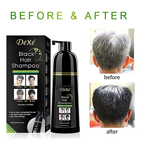 Instant black hair shampoo, hair dye shampoo for men and women - easy to use - quick and easy - lasts 30 days 3 in 1 black hair dye (Bottled)