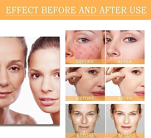 Glycolic Acid 7% Toning Resurfacing Solution,Ordinary Glycolic Acid Toning Solution,Exfoliate, Brighten,and Rejuvenate Your Skin