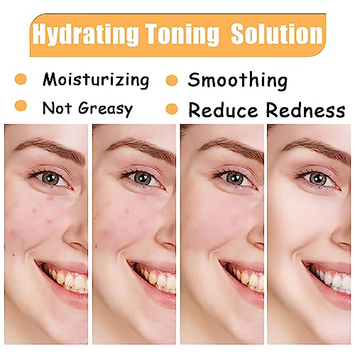 Glycolic Acid 7% Toning Solution,Hydrating Toner for Face,Toner for Acne Prone Skin,Glycolic Acid Skin Toner,Smoothing Face Toner for Dry Skin,Re