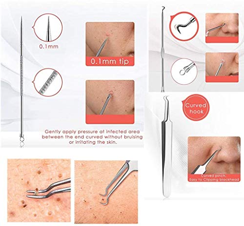 Blackhead Remover Tool Kit Comedone Extractor, Karpo 5 in1 Blackhead Cleaner Tweezers Kit, Curved Professional Stainless Pimple Acne Blemish Remo