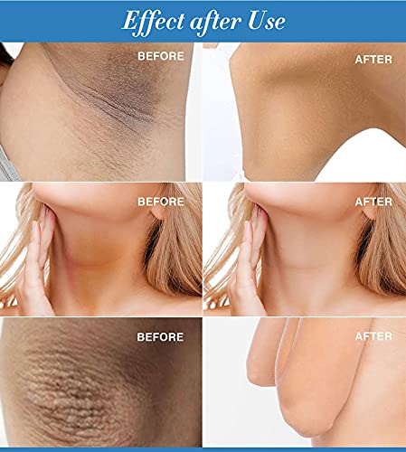 Skin Lightening Cream, Underarm Whitening Cream for Dark Skin and Private Parts, Fade Melanin on Body Armpit Knees Elbows 50g