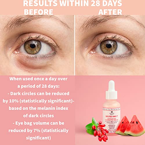 Nature Spell Anti Aging Eye Serum with Watermelon & Goji Berries 30 ml – Targets Dark Circles, Puffiness & Eye bags - Anti Wrinkle Eye Cream - 10