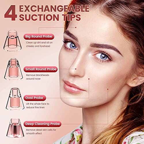 Blackhead Remover Vacuum, Electric Blackhead Remover Vacuum Pore Vacuum with 3 Levels and 4 Suction Heads - Blackhead Suction Remover Blackhead R