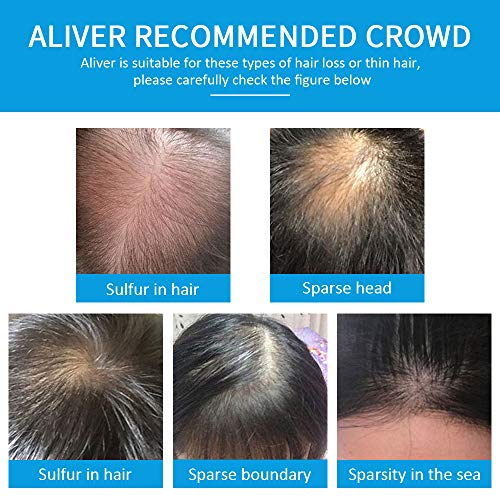 Hair Building Fibres, Professional Quality Fiber Hair Powder, Hair Loss Concealer for Thinning Hair for Women and Men, Best Hair Thickening Produ