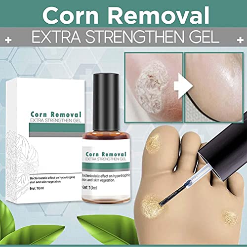 BTSEURY Wart Remover Extra Strengthen Gel, Corn Removal Extra Strengthen Gel, Quick Corn Remover Liquid, Mild Corn Callus Remover for Feet