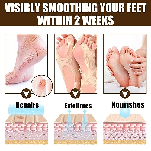 Cracked Skin Repair Cream,Foot Repair Cream,Anti Crack Heel Balm,Quickly Cracked Heel Repair Cream,Feet & Lip & Leg,Foot Cream For Cracked Heels