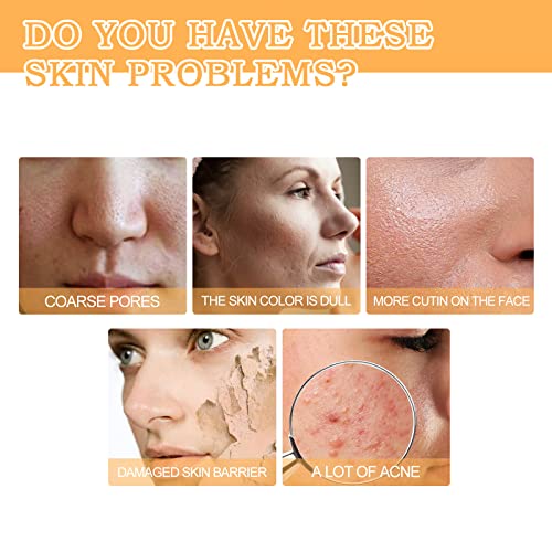 Glycolic Acid 7% Toning Solution, 1pcs Glycolic Acid Toning Resurfacing Solution, Glycolic Sour 7% Toner for Blemishes and Acne, Facial Exfoliati