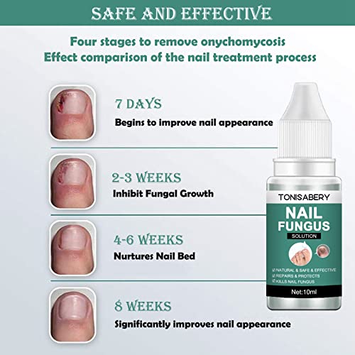 Fungal Nail Treatment for Toenail Extra Strong, Ingrown Toenail Treatment Nail Care Oils, Anti Toe Nail Fungus Treatment for Toenail Nail Fungal