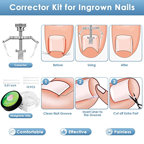 8 PCS Toenail Clippers Kit for Thick or Ingrown Nails, Professional Heavy Duty Ingrown and Thick Toenail Clippers, Sharp Stainless Steel Nail Cut