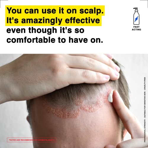 Healpsorin Emollient Balm: Itch Relief Cream Helps Repair Skin Barrier and Treat Conditions Such as Eczema, Psoriasis & Dermatitis - Rash Cream C