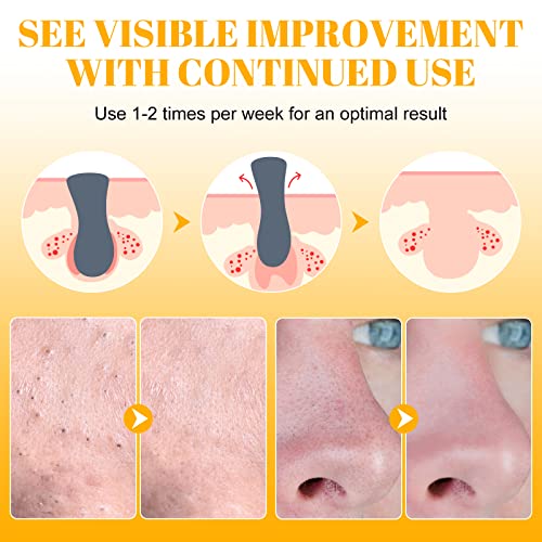 Bieyoc Blackhead Remover Strips(80pcs), Nose Pore Strips for Blackheads Remover, Skincare & Deep Cleansing Nose Strips Blackhead Remover, White,