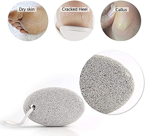 Natural Pumice Stone for Feet 2 PCS, PHOGARY Lava Pedicure Tools Hard Skin Callus Remover for Feet and Hands - Natural Foot File Exfoliation to R