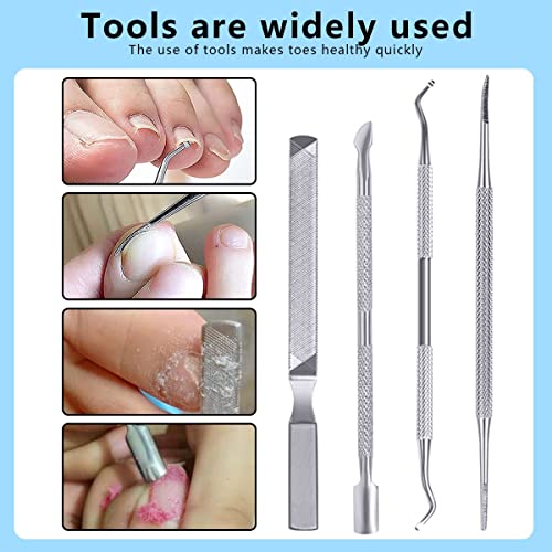 Ingrown Toenail Correction Patch Ingrown Toenail Sticker Patch 50PCS Nail Correction Sticker with 4PCS Nail Correction Tool,Glue-Free Toenail Cor