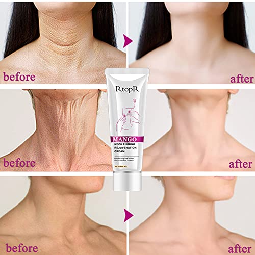 Neck Firming Cream, Neck Cream, Anti Wrinkle Cream, Skin Tightening Cream, Double Chin Reducer Cream, Neck and Chest Tightening Cream, Tightening