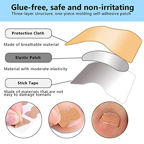 Ingrown Toenail Correction Patch Ingrown Toenail Sticker Patch 50PCS Nail Correction Sticker with 4PCS Nail Correction Tool,Glue-Free Toenail Cor