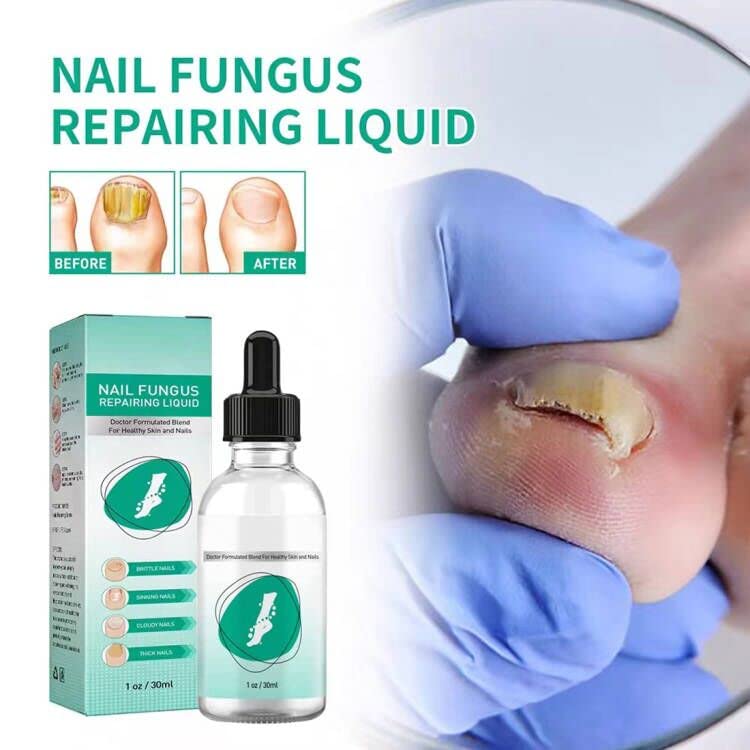 Kerassentials Toenail Fungus Treatment Oil, Best Repair Solution for Fingernails and Toenails, Fix & Renew Damage Fungal Nail, Broken, Cracked &